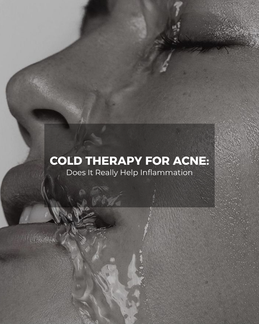 Cold Therapy for Acne: Does It Really Help Inflammation and Breakouts?