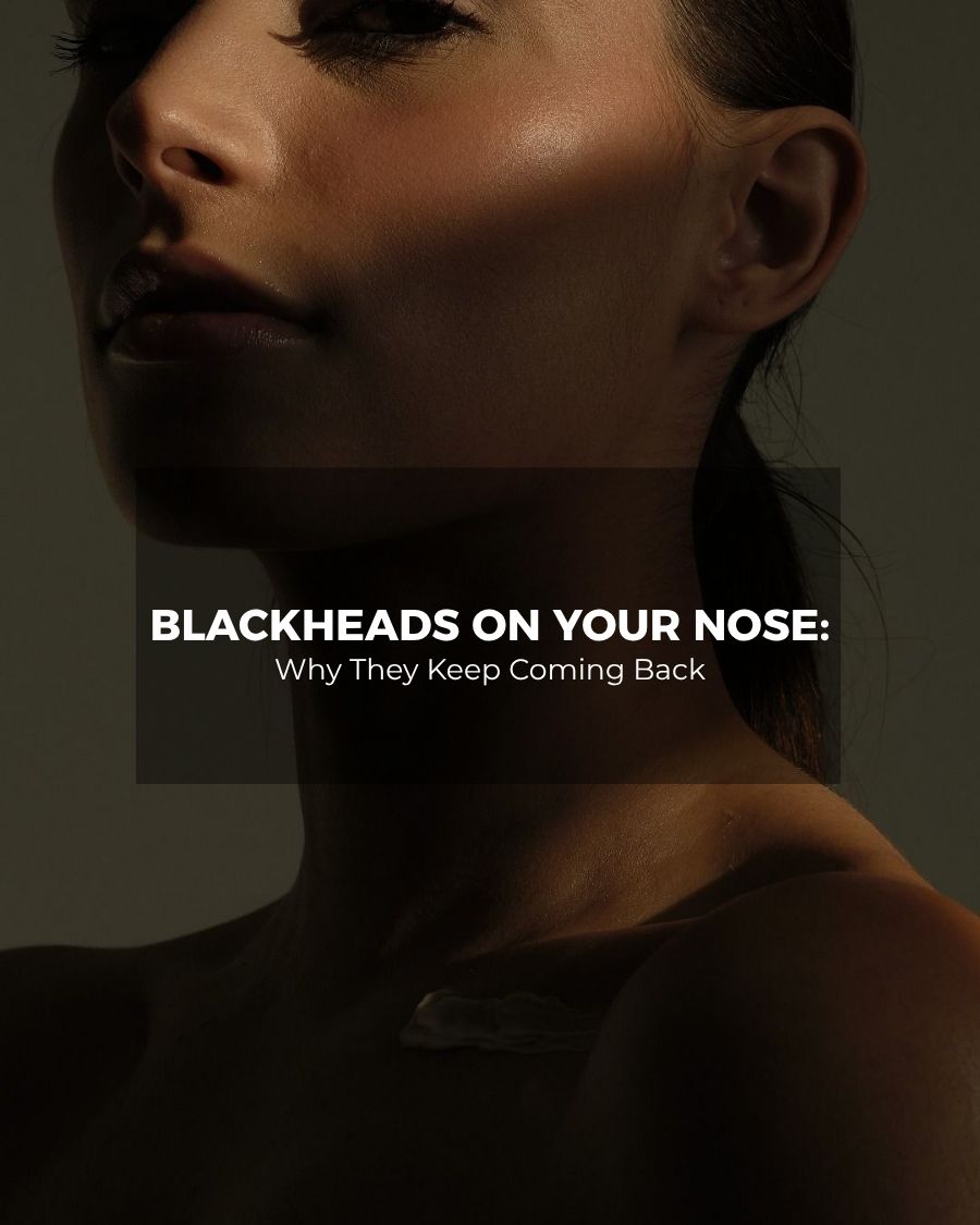 Woman with clear skin – blackheads on the nose and why they keep coming back