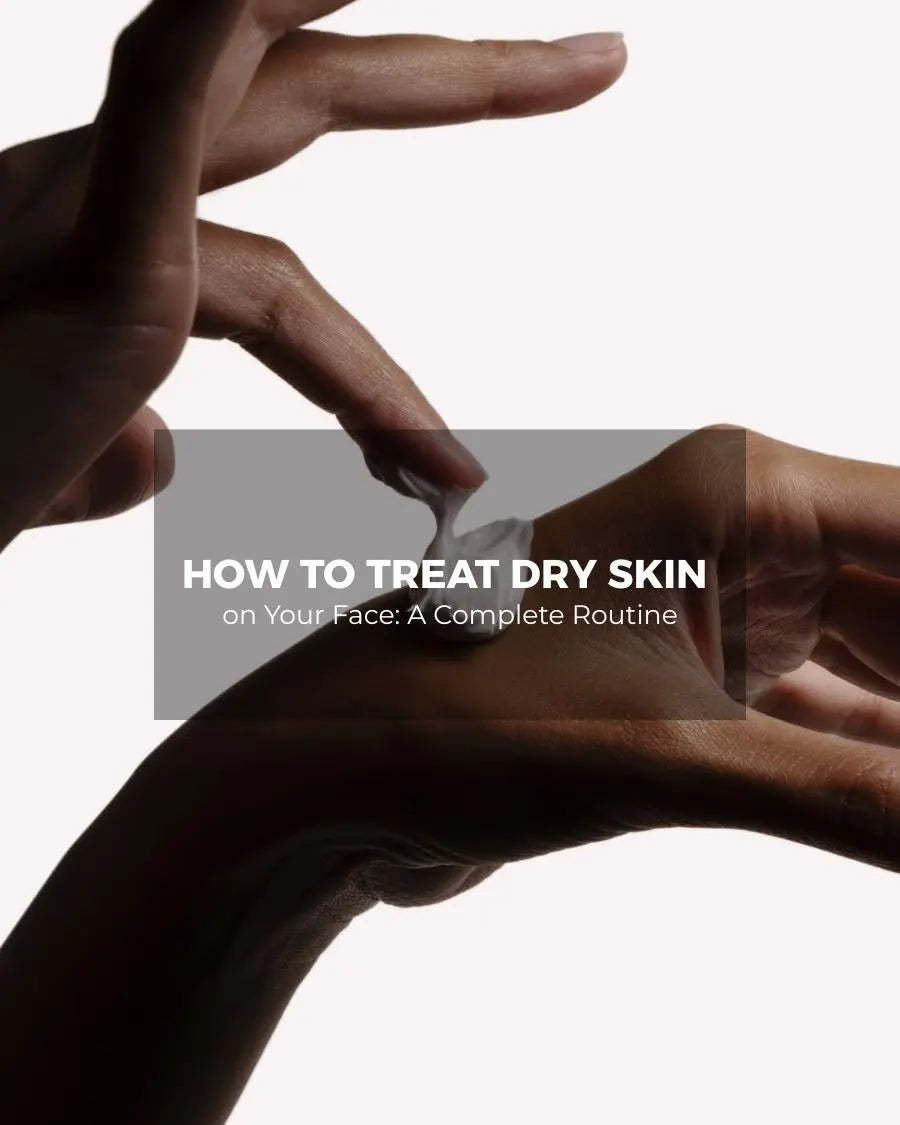 Close-up of hands applying moisturizer to the skin, cover image for the guide on how to treat dry skin on your face